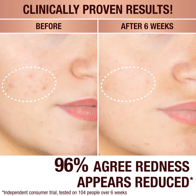 Charlotte Tilbury Dark Spot Correcting Radiance Recovery Serum