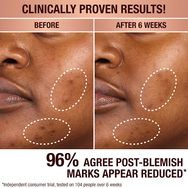 Charlotte Tilbury Dark Spot Correcting Radiance Recovery Serum