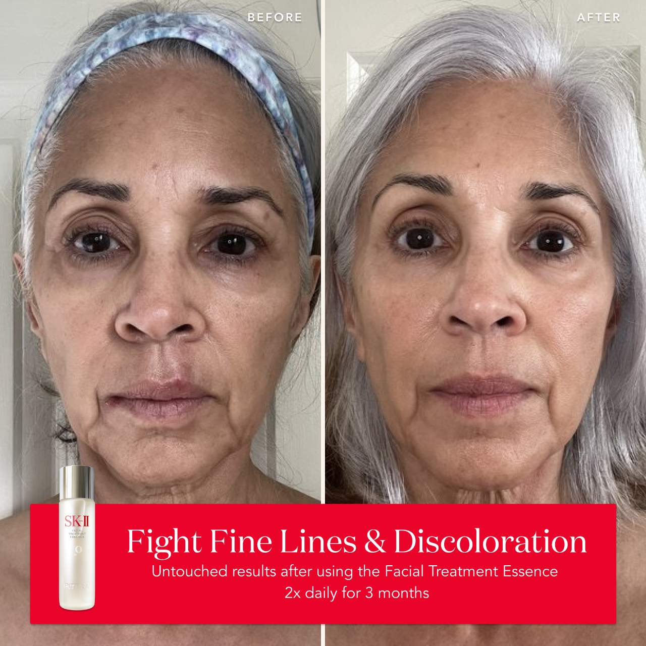 Aging Skin Facial Treatment Essence with Antioxidants