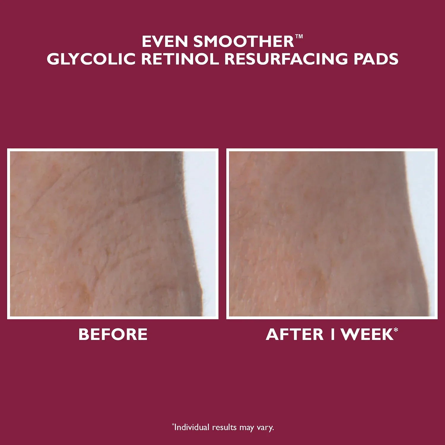 Even Smoother™ Glycolic Retinol Resurfacing Peel Pads