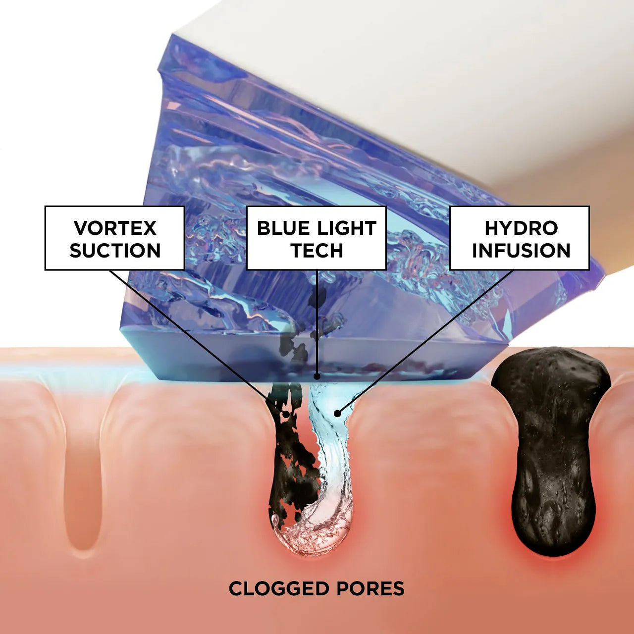 GLOfacial Hydro-Infusion Pore Cleansing + Blue LED Clarifying Tool