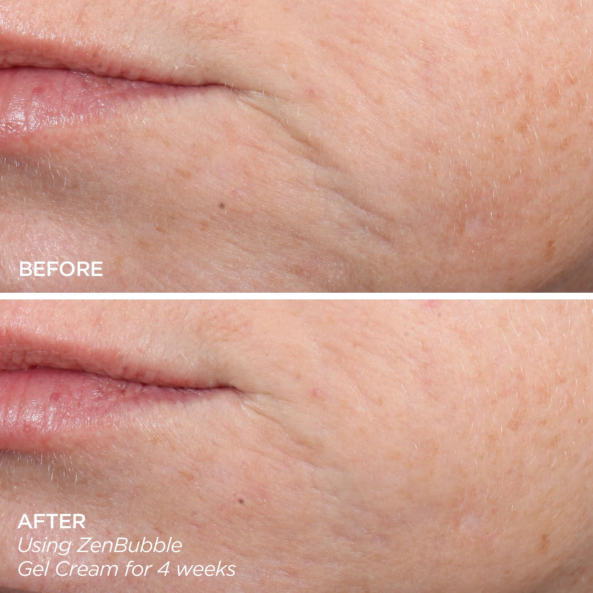 Get That Glow - GloPRO® Microneedling Tool & Discovery Set