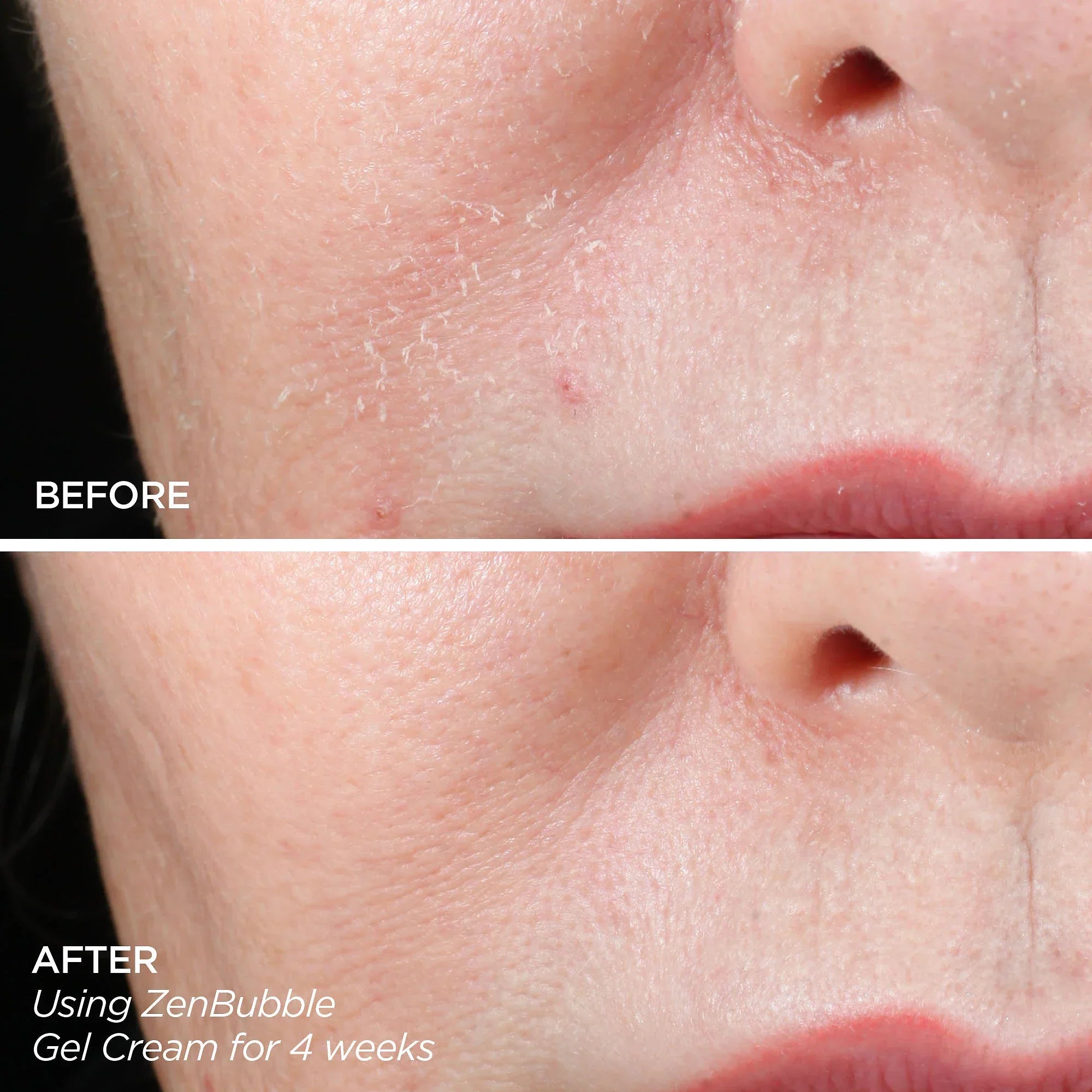 Get That Glow - GloPRO® Microneedling Tool & Discovery Set