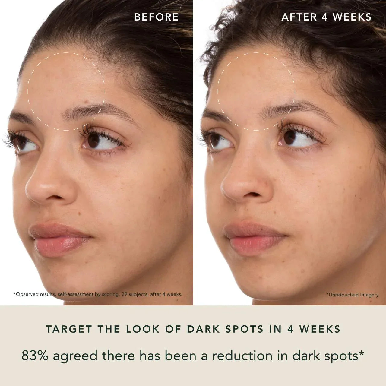 Radiant Rani- Saffron Brightening Dark Spot Treatment