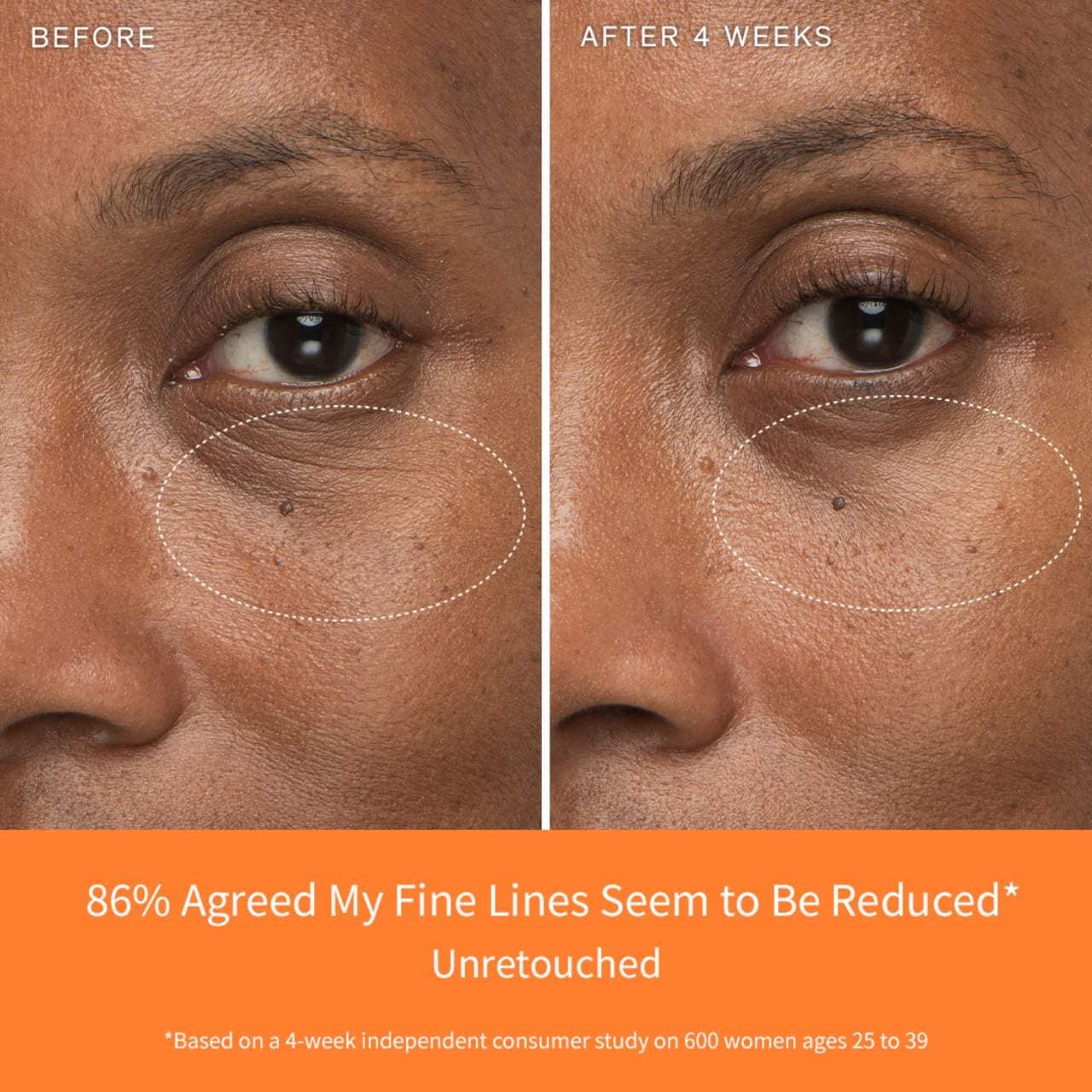 First Care Activating Serum for Anti-Aging