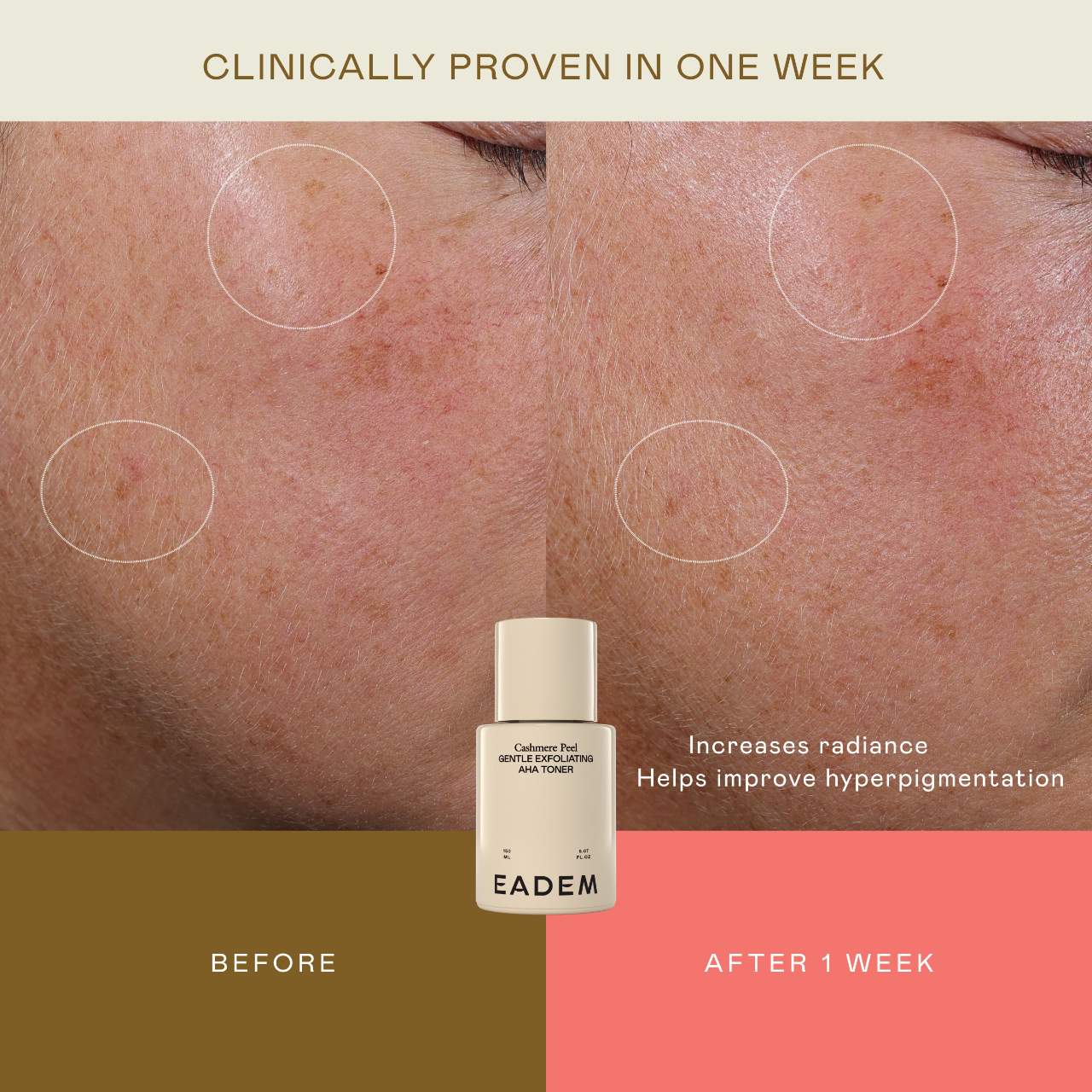 Cashmere Peel Gentle AHA + PHA Exfoliating Toner with 9% Lactic, Azelaic, Tranexamic Acids