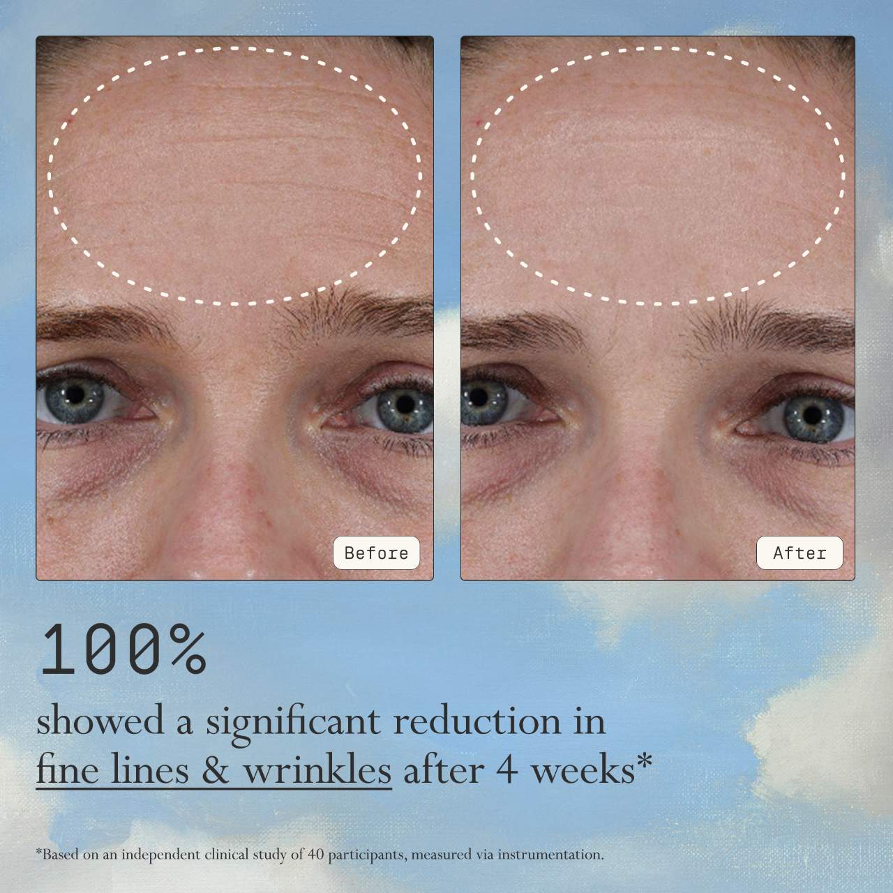 Instant Angel Lipid & Peptide-Rich Moisturizer + Barrier Repair