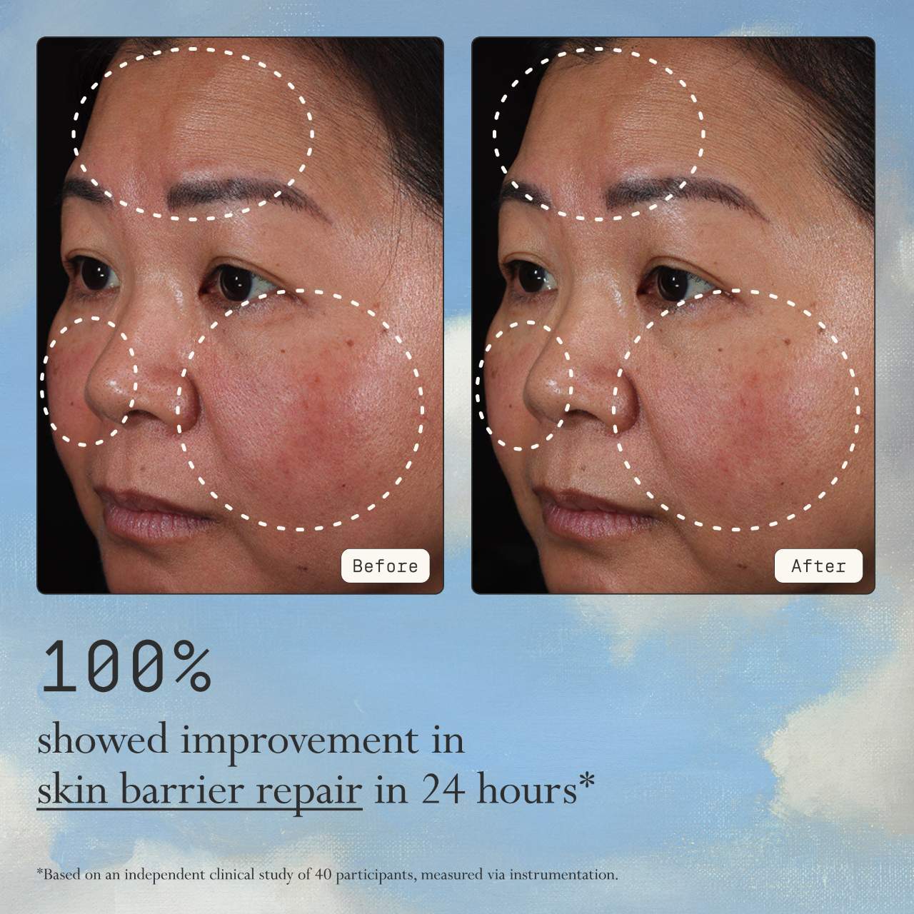 Instant Angel Lipid & Peptide-Rich Moisturizer + Barrier Repair