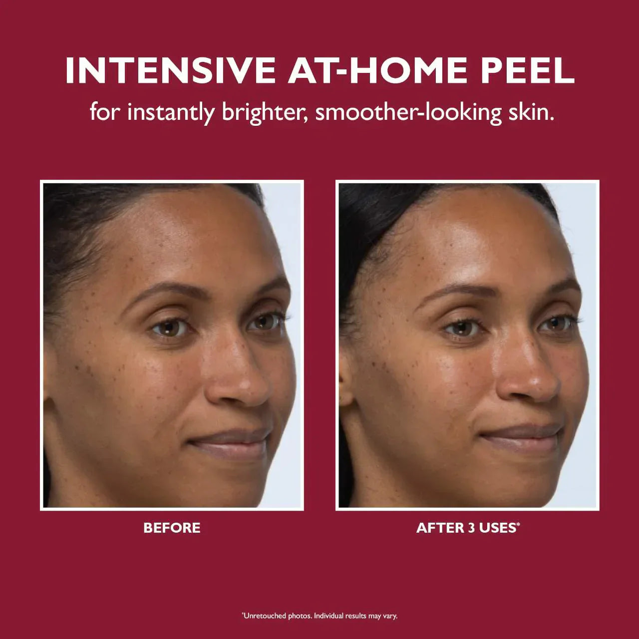 Even Smoother™ Instant Reveal Facial Peel
