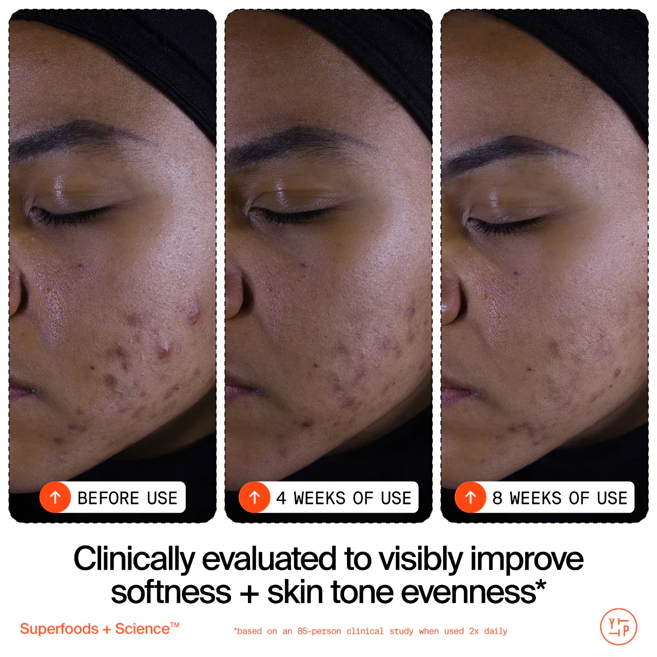 Superfruit Gentle Exfoliating Cleanser with Vitamin C + Papaya