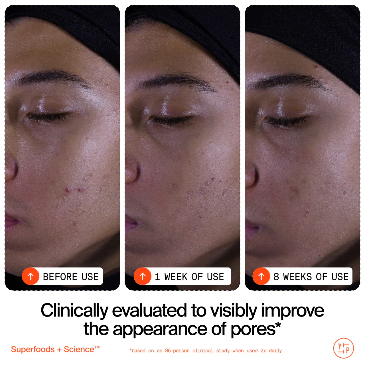 Superfruit Gentle Exfoliating Cleanser with Vitamin C + Papaya