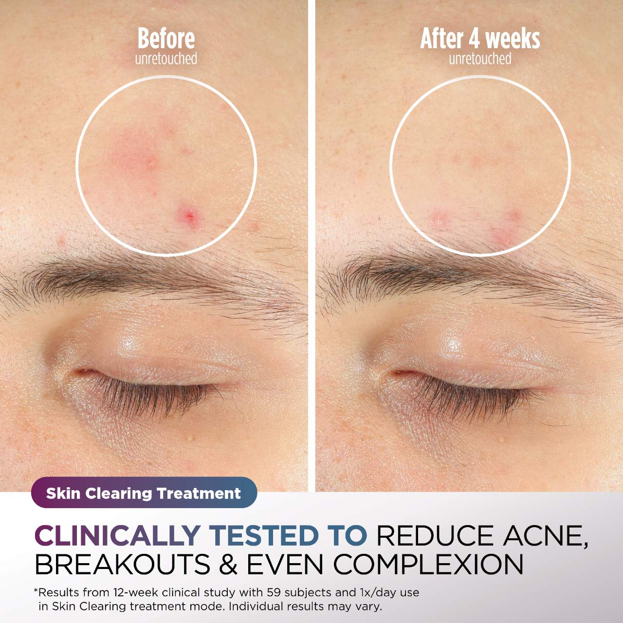 CryoGlow™ Cooling + LED Face Mask