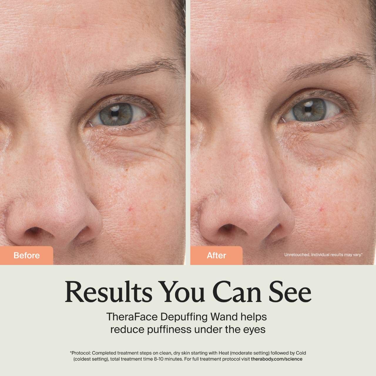 TheraFace Depuffing Wand for Under Eye Bags & Dark Circles