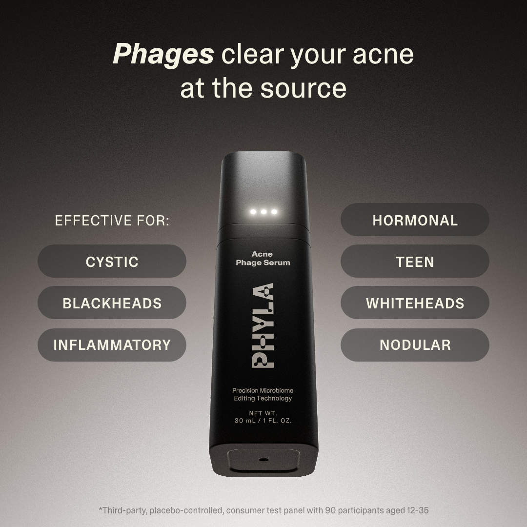 Acne Phage System