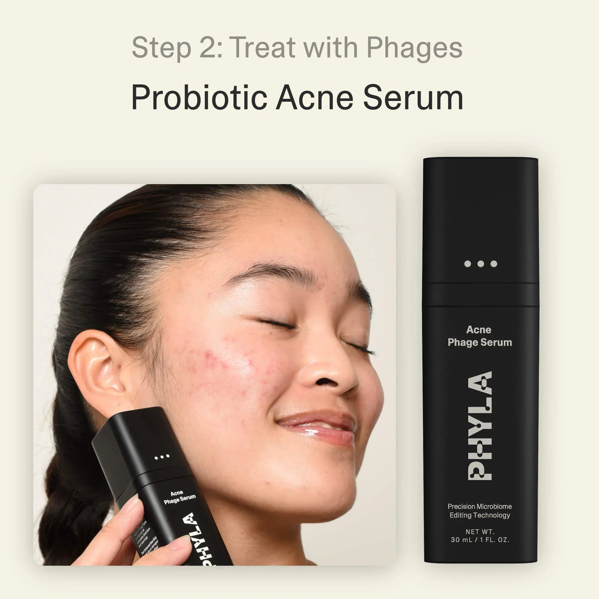 Acne Phage System