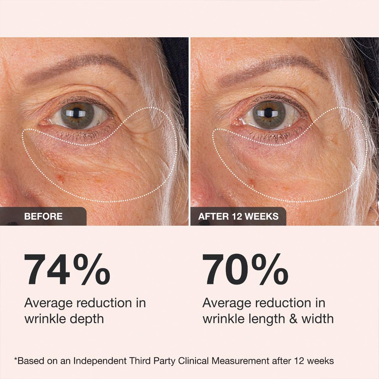 Extreme Cream Eye Firming & Contouring Refillable Eye Cream